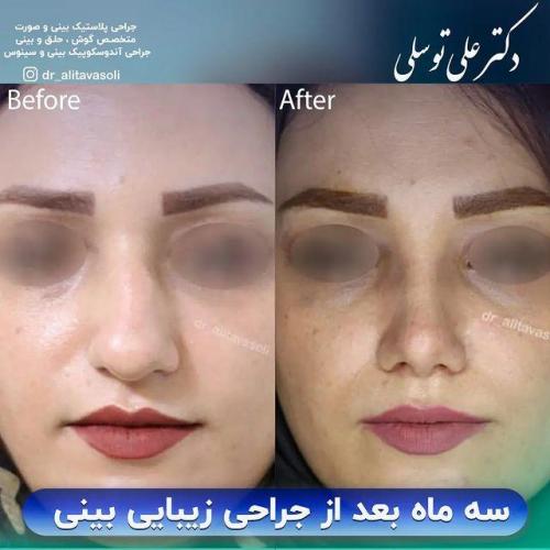 جراحی-بینی328