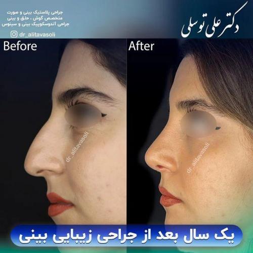 جراحی-بینی329