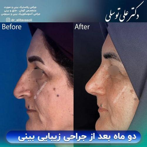جراحی-بینی341