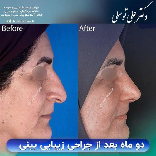 جراحی-بینی342
