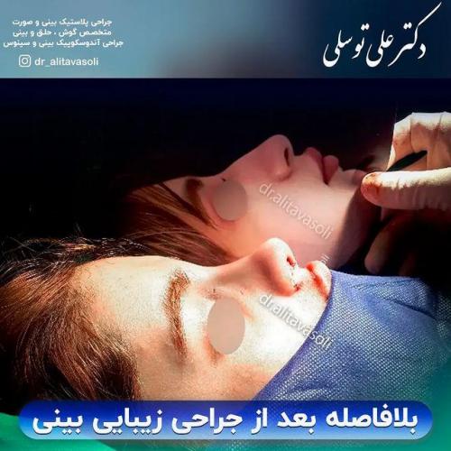جراحی-بینی343