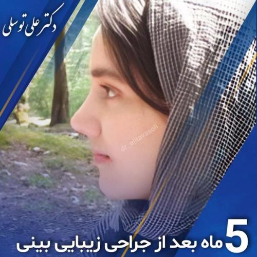 جراحی-بینی395