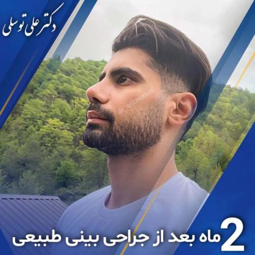 جراحی-بینی396