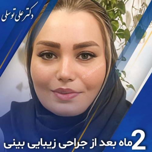 جراحی-بینی397