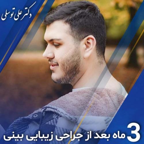 جراحی-بینی400