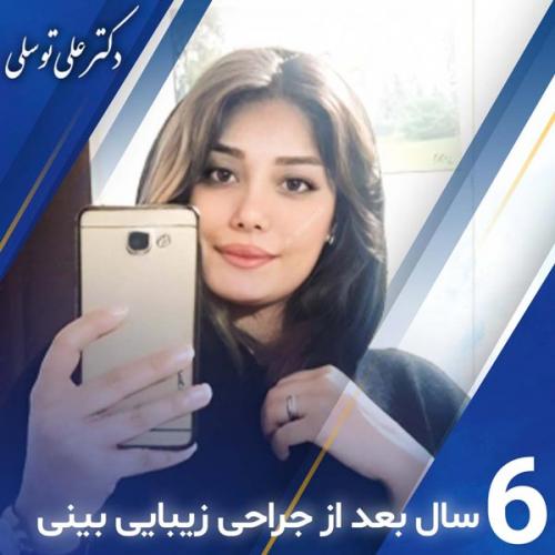 جراحی-بینی401