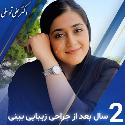 جراحی-بینی402