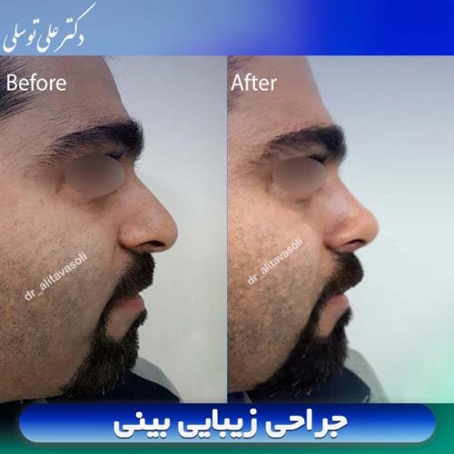 جراحی-بینی403