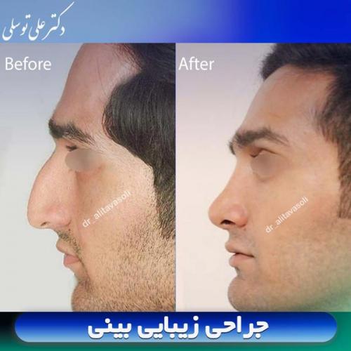 جراحی-بینی404