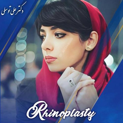 جراحی-بینی407