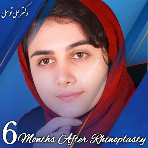 جراحی-بینی408
