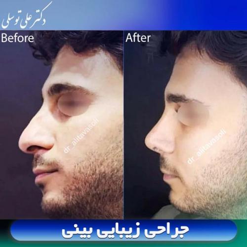 جراحی-بینی410