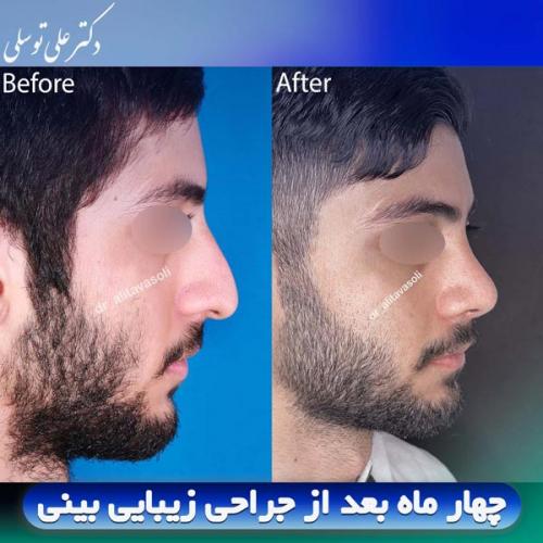 جراحی-بینی412