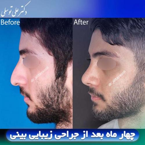 جراحی-بینی413
