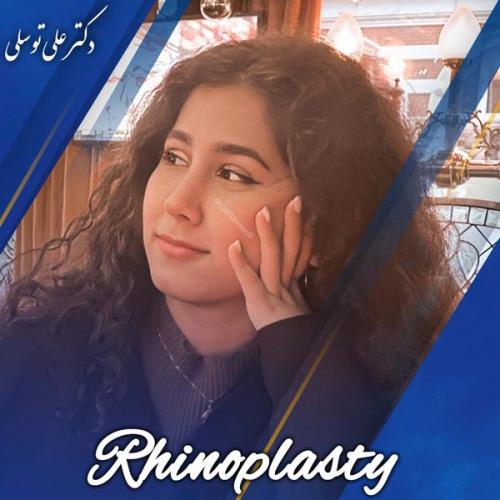 جراحی-بینی419