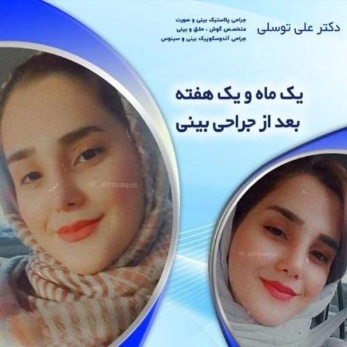 جراحی بینی 150 (25)