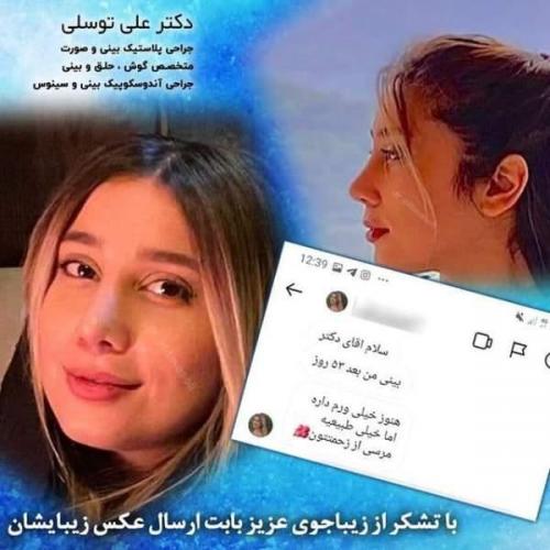 جراحی بینی 150 (65)