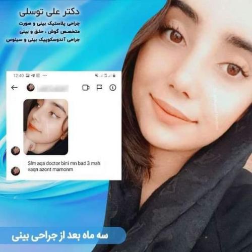 جراحی بینی 150 (66)